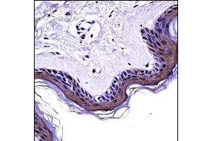 NCK2 Antibody (N-term) ((ABIN658028 and ABIN2846966))immunohistochemistry analysis in formalin fixed and paraffin embedded human skin tissue followed by peroxidase conjugation of the secondary antibody and DAB staining. (NCK2 antibody  (N-Term))