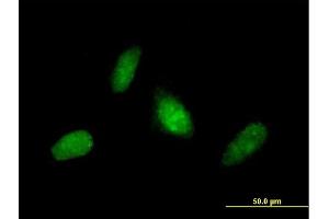 Immunofluorescence of purified MaxPab antibody to ZNF313 on HeLa cell.
