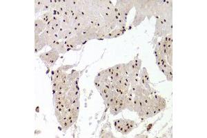 Immunohistochemistry (Paraffin-embedded Sections) (IHC (p)) image for anti-X-Ray Repair Complementing Defective Repair in Chinese Hamster Cells 6 (XRCC6) (AA 500-600) antibody (ABIN1513143)