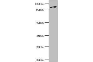 Western blot All lanes: DNA replication licensing factor MCM6 antibody at 3 μg/mL + Jurkat whole cell lysate Secondary Goat polyclonal to rabbit IgG at 1/10000 dilution Predicted band size: 93 kDa Observed band size: 93 kDa (MCM6 antibody  (AA 562-821))