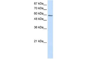 WB Suggested Anti-TP73 Antibody Titration:  2. (Tumor Protein p73 antibody  (N-Term))