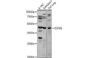 Western blot analysis of extracts of various cell lines, using C3 antibody (ABIN6131229, ABIN6137771, ABIN6137772 and ABIN6221976) at 1:1000 dilution. (C3AR1 antibody  (AA 161-337))