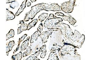 IHC analysis of GRHL2 using anti-GRHL2 antibody (ABIN7599505). (GRHL2 antibody  (AA 1-625))