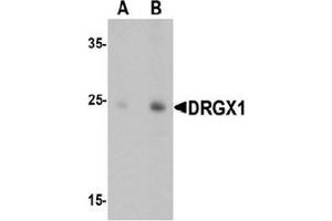 Western blot analysis of DRGX in rat liver tissue lysate with DRGX Antibody  at (A) 1 and (B) 2 ug/mL. (DRGX antibody  (C-Term))