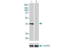 Western blot analysis of ANXA2 over-expressed 293 cell line, cotransfected with ANXA2 Validated Chimera RNAi (Lane 2) or non-transfected control (Lane 1). (Annexin A2 antibody  (AA 1-339))