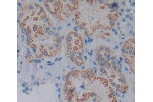 Used in DAB staining on fromalin fixed paraffin- embedded kidney tissue (ACP6 antibody  (AA 1-428))