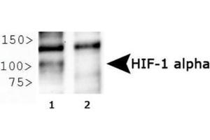 Image no. 10 for anti-Hypoxia Inducible Factor 1, alpha Subunit (Basic Helix-Loop-Helix Transcription Factor) (HIF1A) (AA 329-530) antibody (ABIN363210)