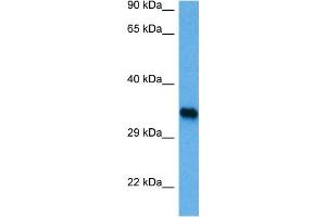 Host:  Rabbit  Target Name:  IRF1  Sample Tissue:  Mouse Brain  Antibody Dilution:  1ug/ml (IRF1 antibody  (C-Term))