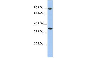 WB Suggested Anti-SLC10A7 Antibody Titration:  0. (SLC10A7 antibody  (Middle Region))