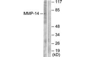 Western blot analysis of extracts from NIH-3T3 cells, using MMP-14 Antibody. (MMP14 antibody  (AA 471-520))