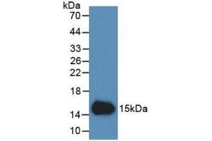 Detection of Recombinant Cys-c, Human using Monoclonal Antibody to Cystatin C (Cys-C) (CST3 antibody  (AA 27-146))