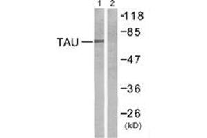 Western blot analysis of extracts from mouse brain cells, using Tau (Ab-212) Antibody. (tau antibody  (AA 496-545))