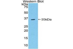 Western Blotting (WB) image for anti-Raftlin, Lipid Raft Linker 1 (RFTN1) (AA 207-451) antibody (ABIN1860396) (RFTN1 antibody  (AA 207-451))