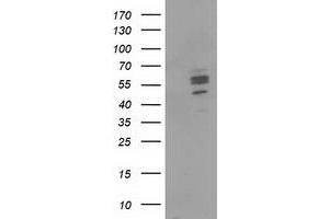 Image no. 1 for anti-Carnosine Dipeptidase 1 (Metallopeptidase M20 Family) (CNDP1) antibody (ABIN1497547) (CNDP1 antibody)