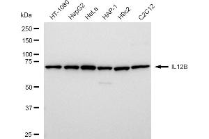 anti-Interleukin 12 beta (IL12B) antibody