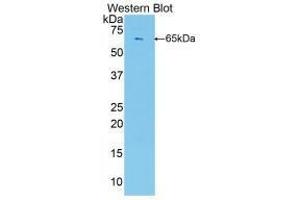 Western blot analysis of the recombinant protein. (Polybromo 1 antibody  (AA 1-306))