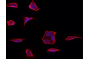 ABIN6261368 and ABIN6273232 staining Hela by IF/ICC.