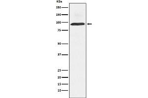Western blot analysis of Dynamin 3 expression in Human fetal brain lysate.