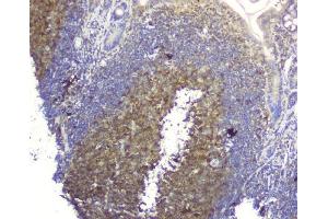 IHC analysis of SQSTM1 using anti-SQSTM1 antibody (ABIN3043937). (SQSTM1 antibody  (N-Term))