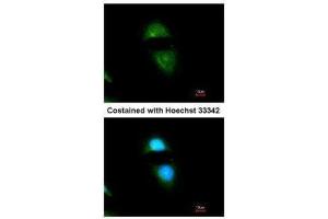 ICC/IF Image Immunofluorescence analysis of methanol-fixed HeLa, using Cytochrome P450 Reductase, antibody at 1:200 dilution. (POR antibody  (N-Term))