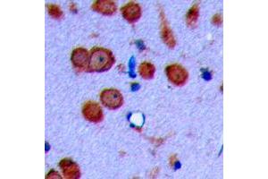 Immunohistochemical analysis of Cadherin 19 staining in human brain formalin fixed paraffin embedded tissue section. (CDH19 antibody  (Center))