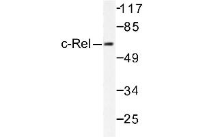 Image no. 1 for anti-REL proto-oncogene (c-Rel) antibody (ABIN271805)