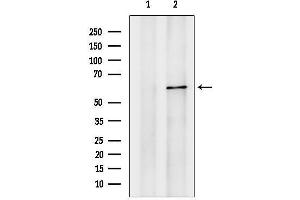 anti-Phosphatidylinositol-4-Phosphate 5-Kinase, Type I, beta (PIP5K1B) (C-Term) antibody