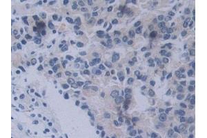 Immunohistochemistry (IHC) image for anti-Neuropilin 2 (NRP2) (AA 231-490) antibody (ABIN7435322)