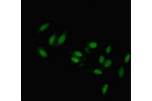 Immunofluorescent analysis of Hela cells using ABIN7173229 at dilution of 1:100 and Alexa Fluor 488-congugated AffiniPure Goat Anti-Rabbit IgG(H+L) (Transmembrane Protein 47 (TMEM47) (AA 42-82) antibody)