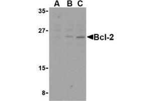 Western blot analysis of Bcl-2 in A-20 cell lysates with AP30129PU-N Bcl-2 antibody at (A) 1, (B) 2, and (C) 4 μg/ml. (Bcl-2 antibody  (Intermediate Domain))