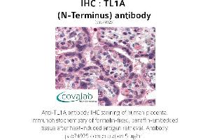 Image no. 1 for anti-Tumor Necrosis Factor (Ligand) Superfamily, Member 15 (TNFSF15) antibody (ABIN1740101) (TNFSF15 antibody)