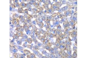 Immunohistochemistry of paraffin-embedded Mouse liver using CCBL1 Polyclonal Antibody at dilution of 1:100 (40x lens). (CCBL1 antibody)