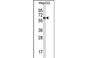 TBC1D22A Antibody (C-term) (ABIN656780 and ABIN2845998) western blot analysis in HepG2 cell line lysates (35 μg/lane). (TBC1D22A antibody  (C-Term))