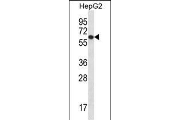 TBC1D22A anticorps  (C-Term)