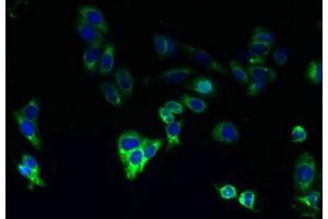 Immunofluorescent analysis of HepG2 cells using ABIN7163430 at dilution of 1:100 and Alexa Fluor 488-congugated AffiniPure Goat Anti-Rabbit IgG(H+L) (CYP4F11 antibody  (AA 38-524))