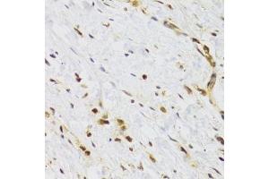 Immunohistochemistry of paraffin-embedded human stomach using RAD50 Antibody. (RAD50 antibody)