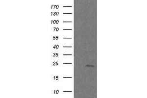 Image no. 3 for anti-RAB21, Member RAS Oncogene Family (RAB21) antibody (ABIN1500545) (RAB21 antibody)