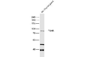 Western Blotting (WB) image for anti-Thyroid Stimulating Hormone Receptor (TSHR) (AA 501-600) antibody (ABIN668901)