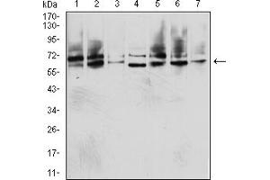 Western Blotting (WB) image for anti-Insulin-Like Growth Factor 2 mRNA Binding Protein 3 (IGF2BP3) (AA 430-579) antibody (ABIN7193581)
