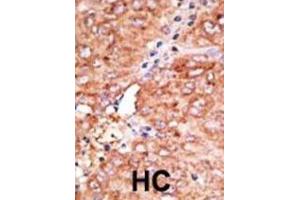 Immunohistochemistry (IHC) image for anti-Chemokine Binding Protein 2 (CCBP2) antibody (ABIN3001324) (CCBP2 antibody)