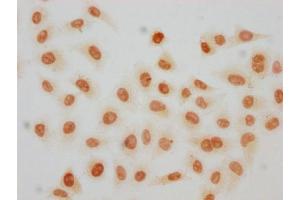 Immunocytochemistry analysis of rHU diluted at 1:100 and staining in Hela cells(treated with 30 mM sodium crotonylate for 4h) performed on a Leica BondTM system. (HIST1H2AG antibody  (AA 116-128))