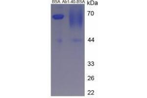 Image no. 2 for Amyloid beta 1-40 (Abeta 1-40) peptide (BSA) (ABIN5665938) (Amyloid beta 1-40 (Abeta 1-40) peptide (BSA))