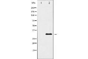 Western blot analysis of hnRNP C1/2 expression in EGF treated HuvEc whole cell lysates,The lane on the left is treated with the antigen-specific peptide.