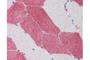 HMGCS1 antibody was used for immunohistochemistry at a concentration of 4-8 ug/ml. (HMGCS1 antibody)