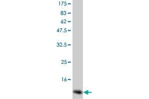 Western Blot detection against Immunogen (14 KDa) . (GM-CSF antibody)