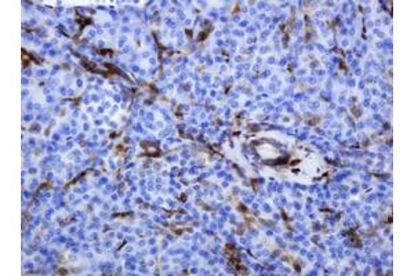 Thymidine Phosphorylase antibody  (AA 311-482)