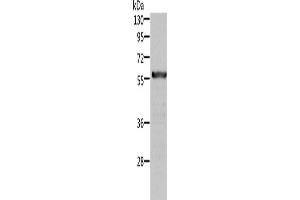 Western Blotting (WB) image for anti-Aldehyde Dehydrogenase 6 Family, Member A1 (ALDH6A1) antibody (ABIN2422525)