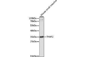 Western blot analysis of extracts of mouse small intestine, using TH antibody (ABIN6133215, ABIN6149107, ABIN6149108 and ABIN6220276) at 1:3000 dilution. (THAP2 antibody  (AA 83-228))