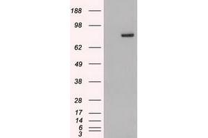 Western Blotting (WB) image for anti-Signal Transducer and Activator of Transcription 4 (STAT4) (AA 633-652) antibody (ABIN1491621) (STAT4 antibody  (AA 633-652))