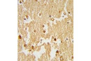 Formalin-fixed and paraffin-embedded human brain tissue reacted with ESRRB Antibody , which was peroxidase-conjugated to the secondary antibody, followed by DAB staining. (ESRRB antibody  (Middle Region))